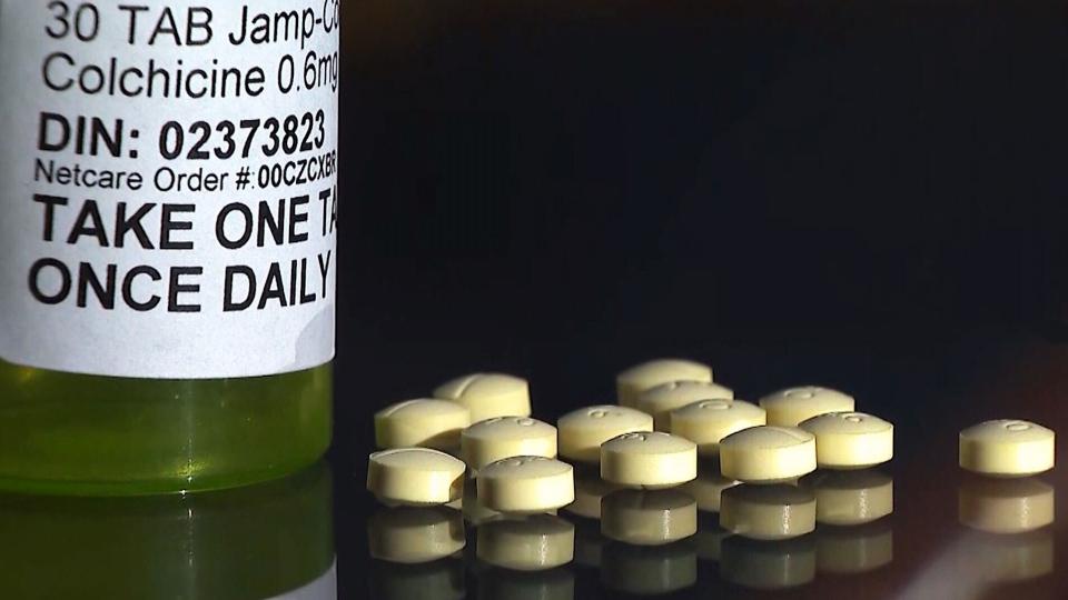 Optimism over use of gout drug in virus treatment