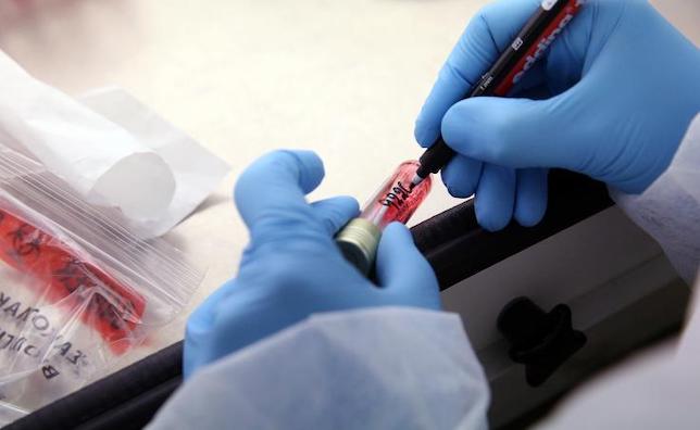 New HIV-1 strain discovered in Cyprus