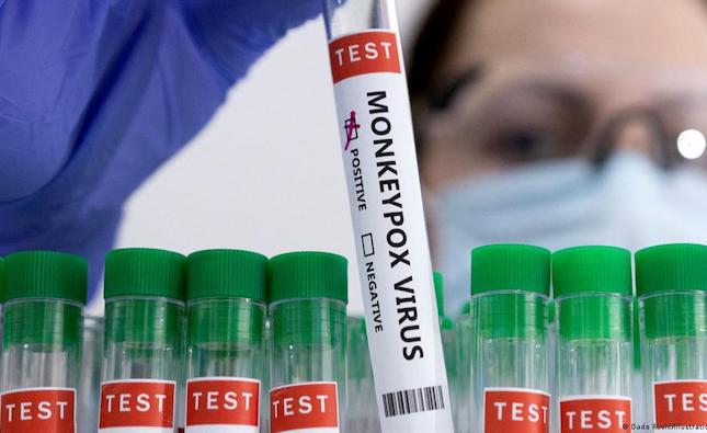 Nicosia general to act as reference hospital for monkeypox as plan finalised