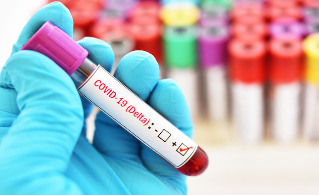 Sequencing shows increase of Delta variant in Cyprus